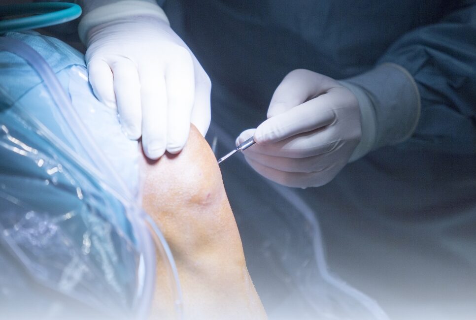 How soon after diagnosis can one typically undergo Arthroscopy Surgery?
